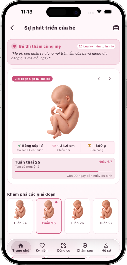 Mô hình 3D thai nhi